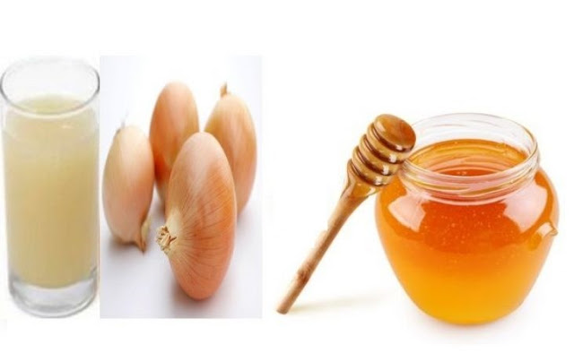 Onion reduces the pain of periods, know its wonderful benefits Funny Jokes Onion reduces the pain of periods, know its wonderful benefits Funny Jokes