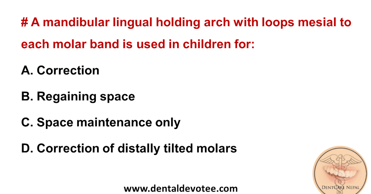 Dentosphere World of Dentistry Lingual holding arch