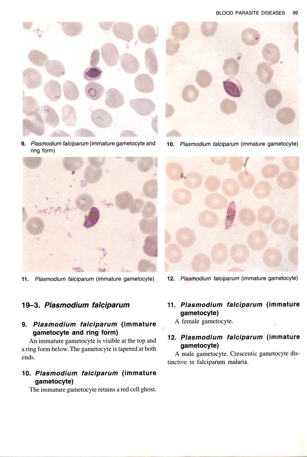 GAMBAR PLASMODIUM Yazhid Blog