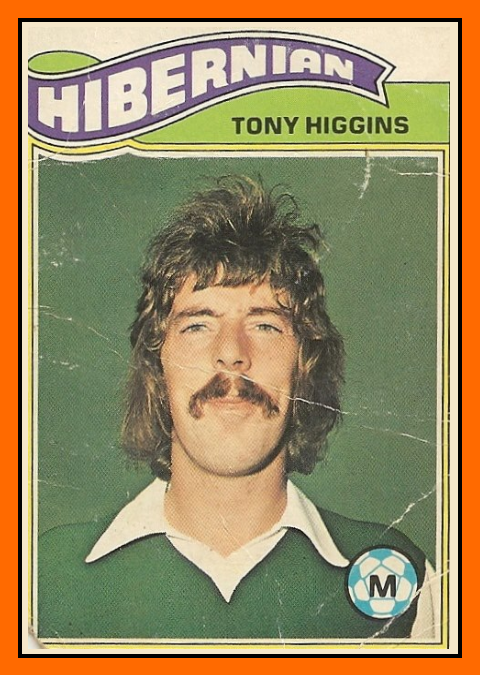 Tony+HIGGINS+-+Hibernian.png