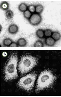 Klasifikasi virus berdasarkan asam nukleat Klasifikasi virus berdasarkan asam nukleat