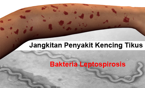 Penyakit Kencing Tikus Leptospirosis Fikirkan Kau Boleh Penyakit Kencing Tikus Leptospirosis Fikirkan Kau Boleh