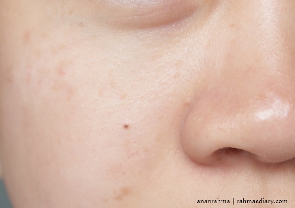 dry and dull skin