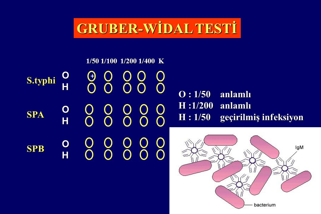 WIDAL REACTION (GRUBER WIDAL) Microbiology Laboratory Turkey