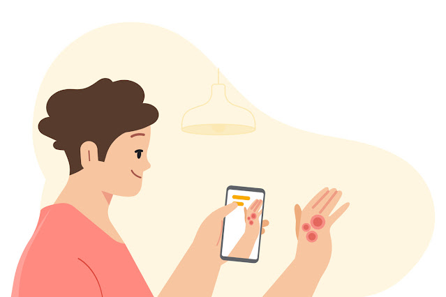 Google application to detect skin diseases