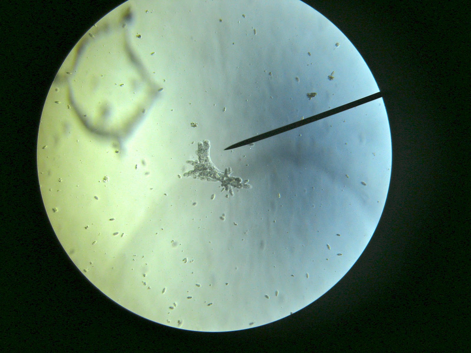 found to occupy 20% of the fov of a microscope at 40x magnification unicell...