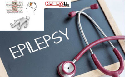 Epilepsy causes, symptoms and treatment أسباب الصرع عند الشباب وأعراضه وطرق علاجه