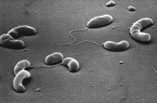 Pengelompokan bakteri berdasarkan bentuk Vibrio contohnya yaitu Vibrio cholerae