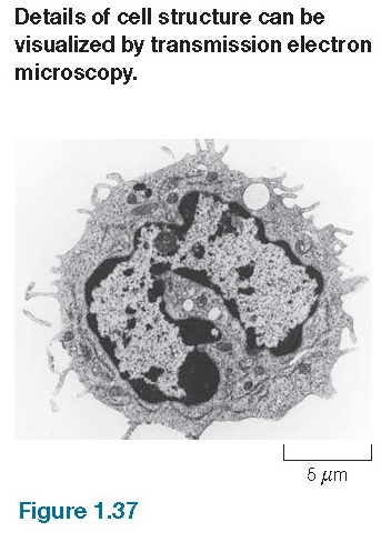 Positive staining Transmission electron micrograph of a white blood cell positively stained by heavy metal salts.
