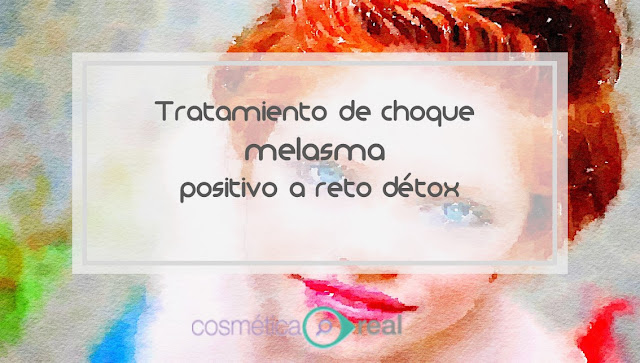 Tratamiento de choque contra el melasma despues de reintroducir factores del reto detox