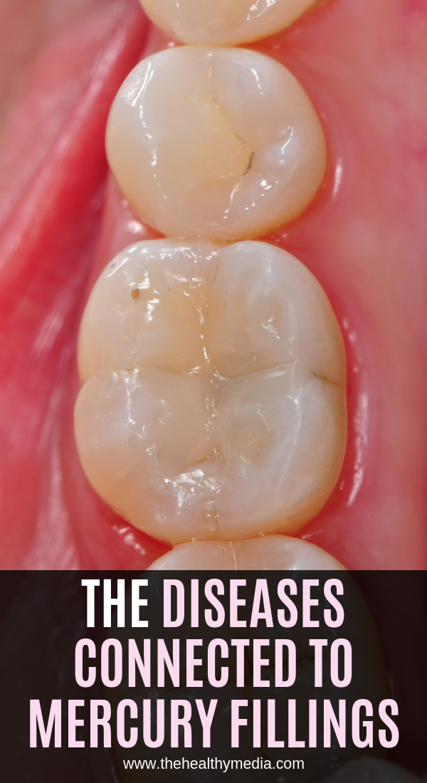 The Diseases Connected to Mercury Fillings