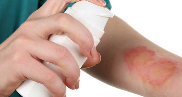 menghilangkan bekas luka