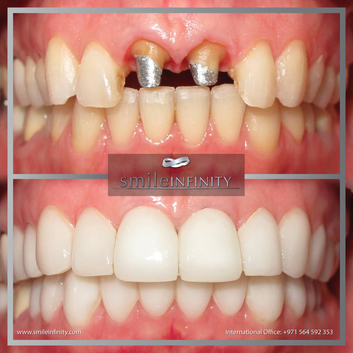 Hollywood Smile Lebanon Elite dentists at CMC Hospital affiliated with
