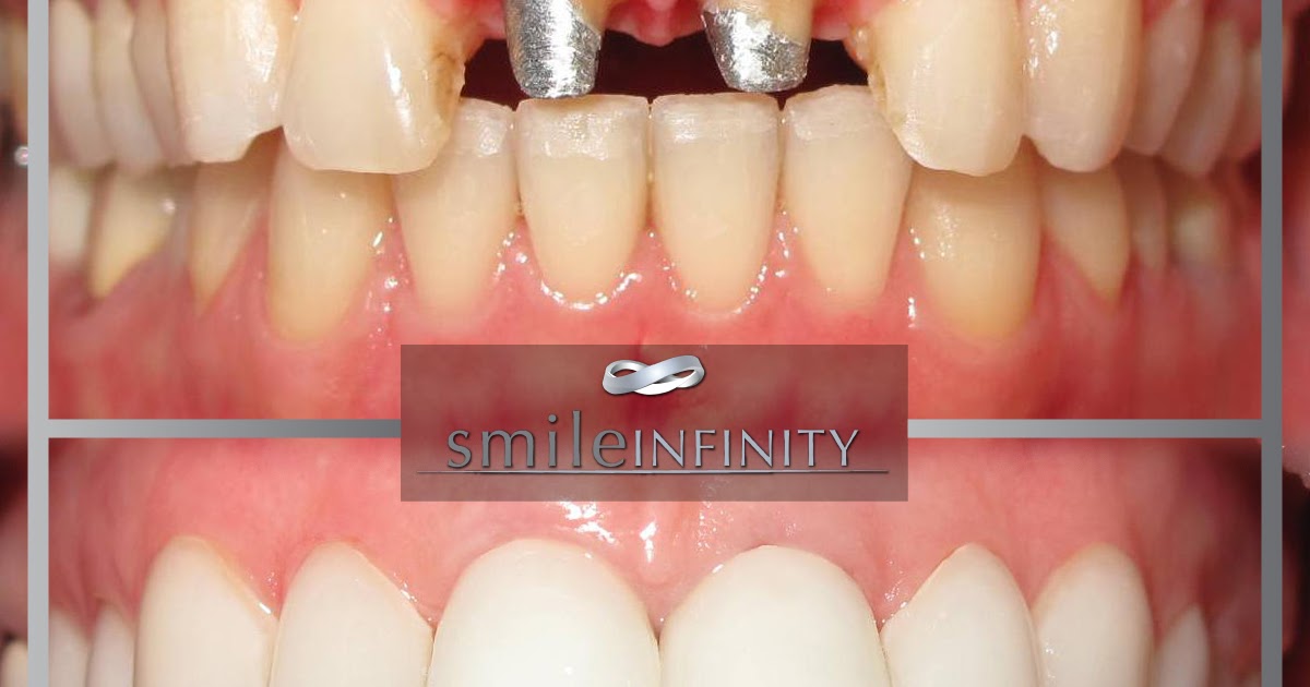 Hollywood Smile Lebanon Elite dentists at CMC Hospital affiliated with