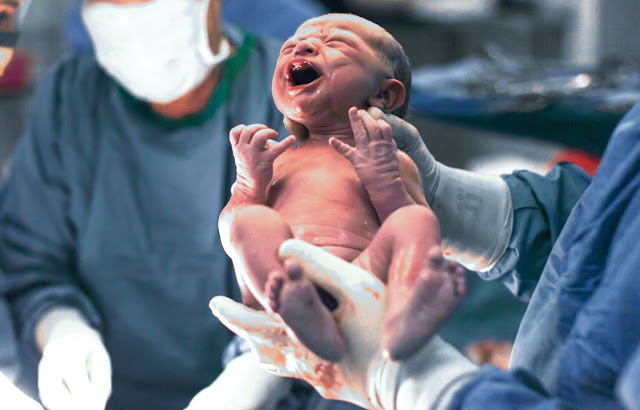 How Long Does Normal Birth and Cesarean Section Last