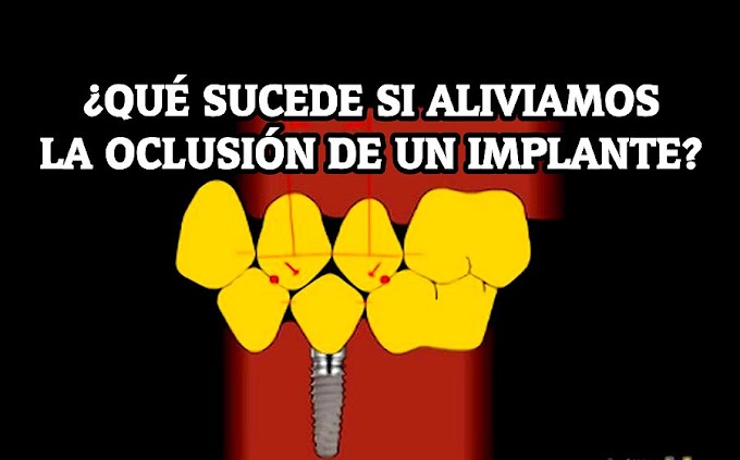 OCLUSIÓN: ¿Qué sucede si aliviamos la oclusión de un implante?