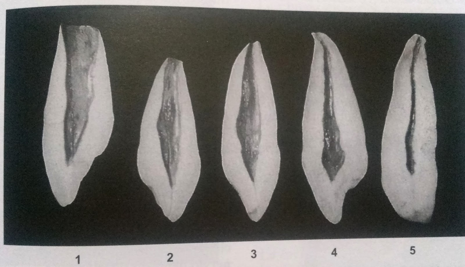 Conociendo sobre la odontologia Pulpa Dental