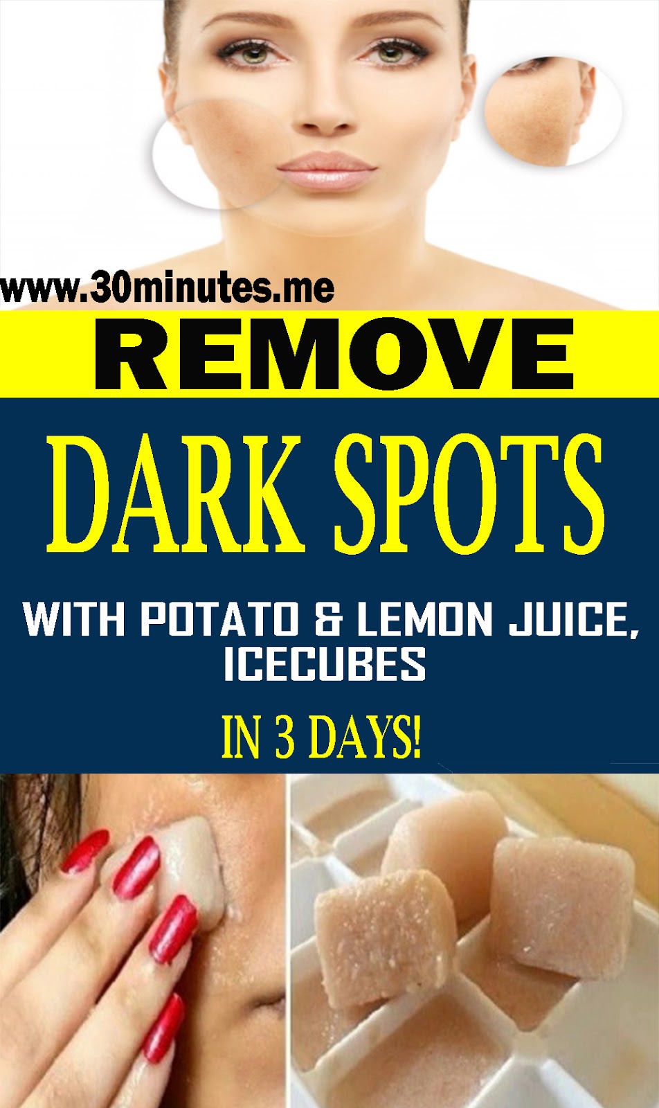 I M SHOCKED IT REMOVED MY DARK SPOTS IN 3 DAYS, POTATO & LEMON JUICE