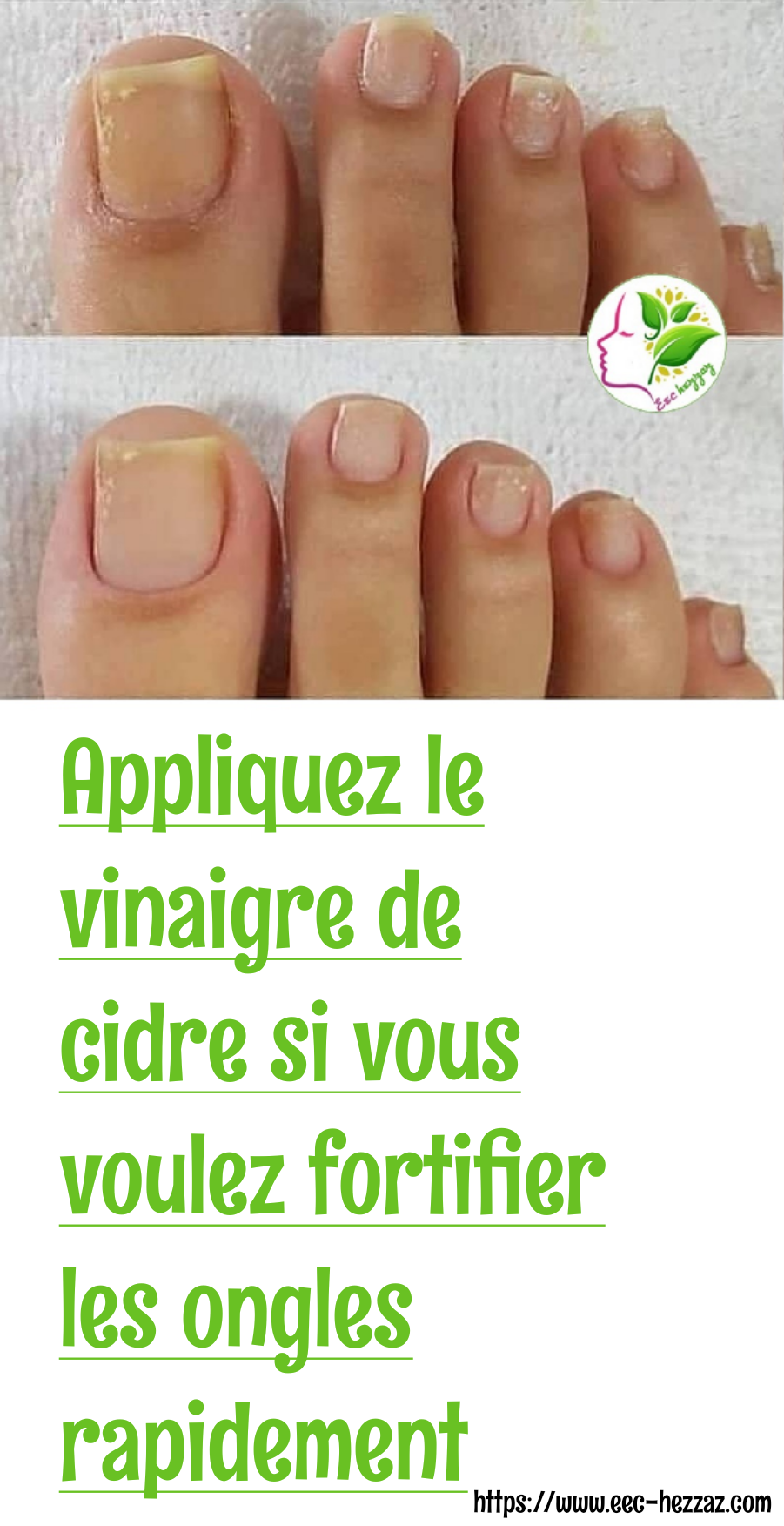 Appliquez le vinaigre de cidre si vous voulez fortifier les ongles rapidement