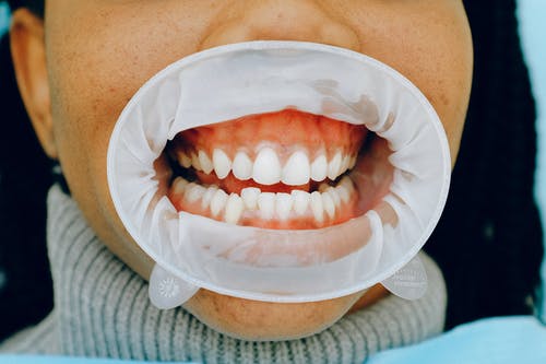 Five Dental Care Practices to Achieve Healthy Teeth and Prevent COVID-19 