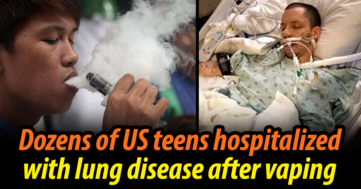 Dozens of US Teens Hospitalized with Lung Disease after Vaping The