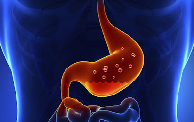 Probióticos y gastritis