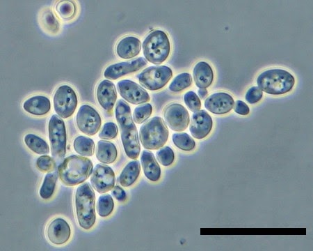 yeast under microscope
