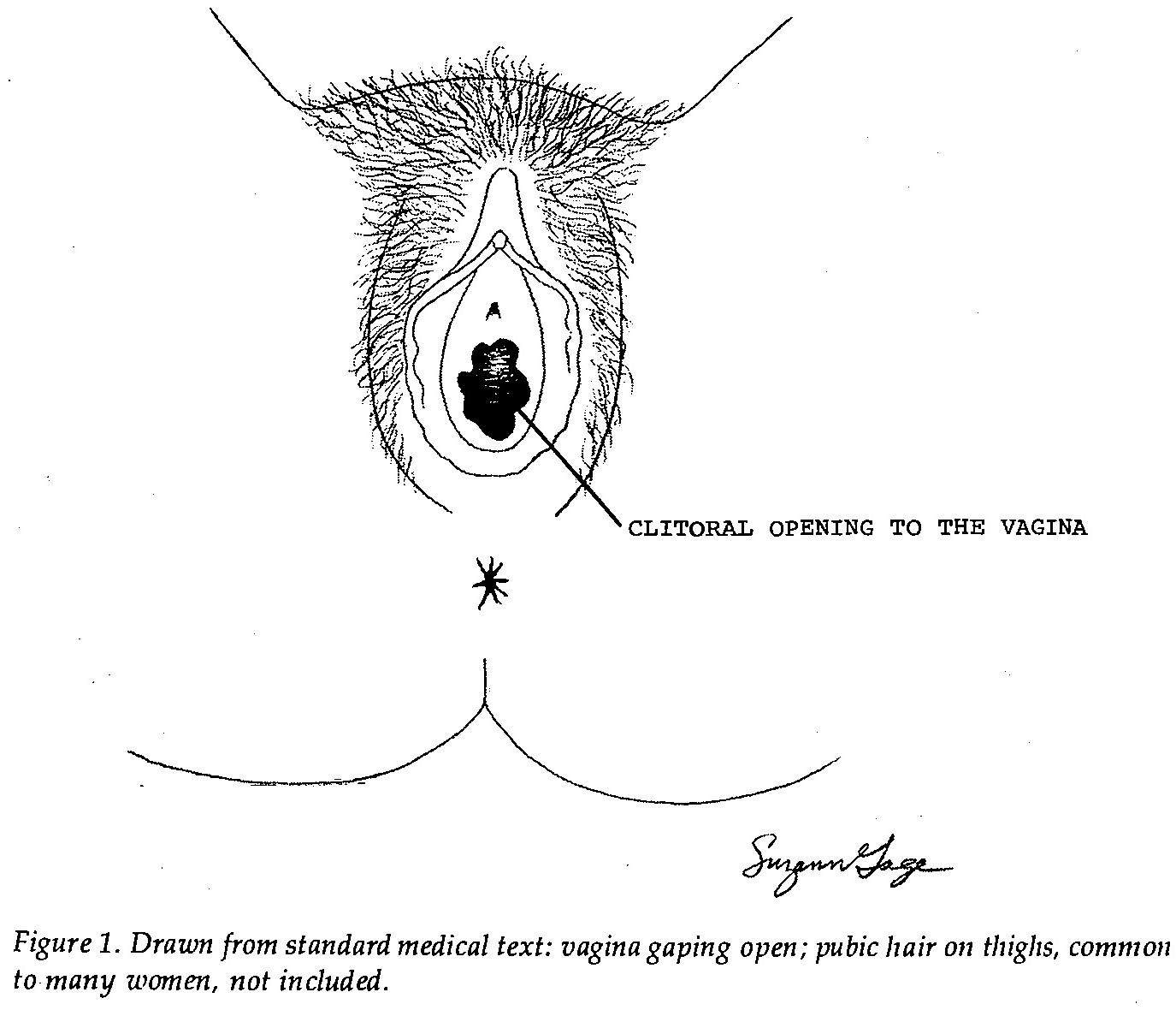 Masturbation Stimulation Women Orgasm Sexual Fingers Parts Clitoris Genitals Hand 118