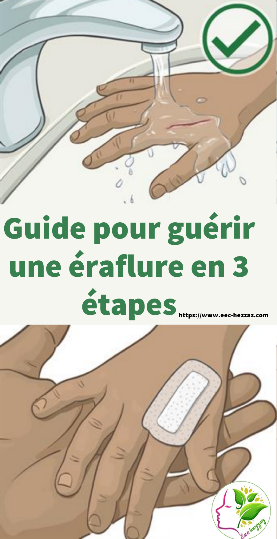 Guide pour guérir une éraflure en 3 étapes