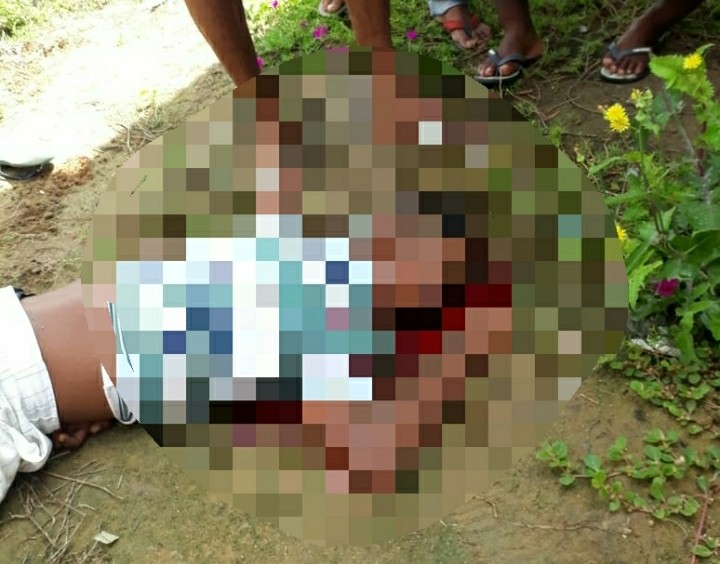 Jovem é baleado na cabeça em tentativa de homicídio em Capim Grosso