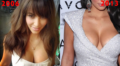 Kim Kardashian nose surgery change 2006 2013 funny