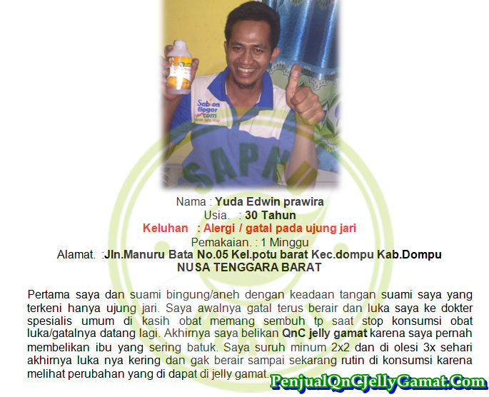 Cara Mengobati Bentol Bernanah Di Tangan Dan Kaki Secara Alami Terbukti Ampuh - TESTIMONI QNC JELLY GAMAT Cara Mengobati Bentol Bernanah Di Tangan Dan Kaki Secara Alami Terbukti Ampuh - TESTIMONI QNC JELLY GAMAT