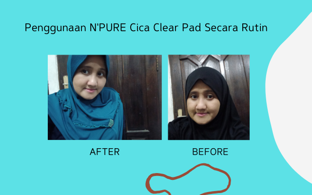 Review npure cica clear pad