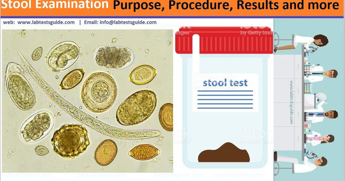 تحليل البراز والديدان والطفيلياتstool analysis lab for arab