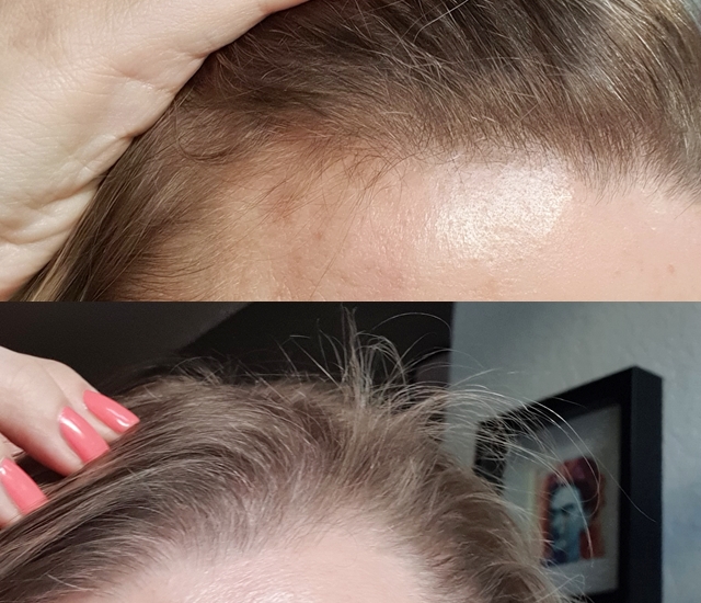 In Love With Life Stressbedingter Haarausfall 3 Tipps Wie Ich Meine Haare Wieder Aufbaue