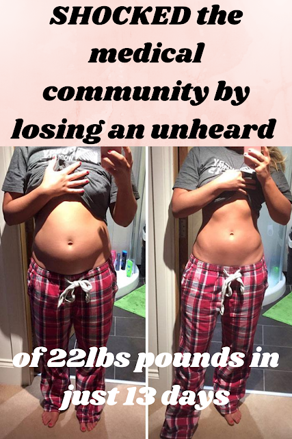 SHOCKED the medical community by losing an unheard of 22lbs pounds in just 13 days