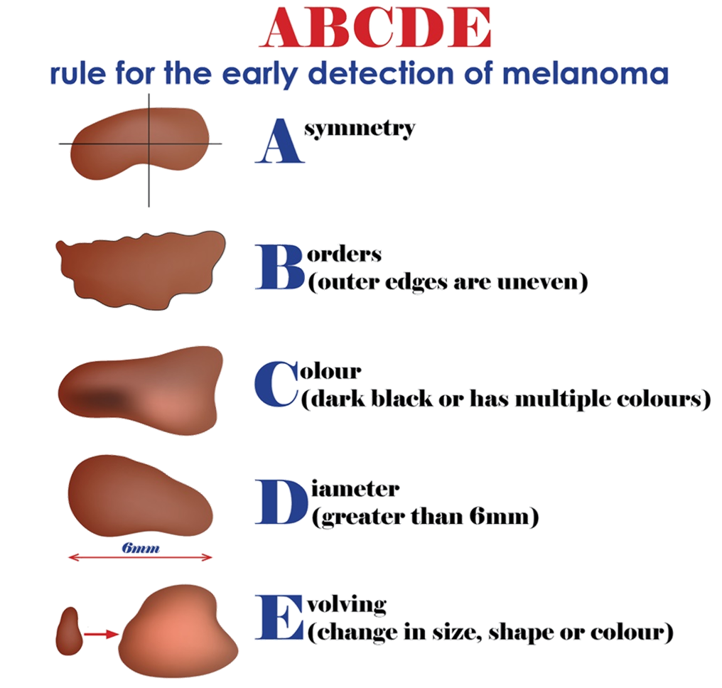 abcd moles abcd moles
