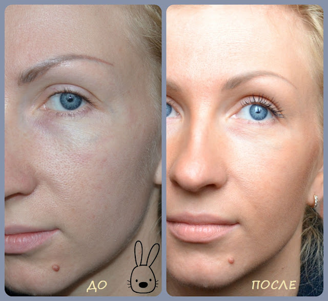 до и после Natiо Mineral Loose Foundation