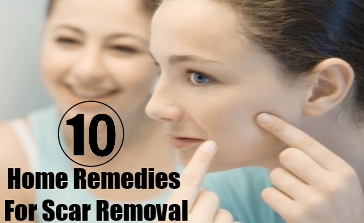 Remedies to get rid of old scars