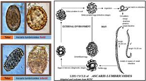 Az Ascaris emberi fertőzésének módjai röviden. Kórokozók jelenléte a szervezetben
