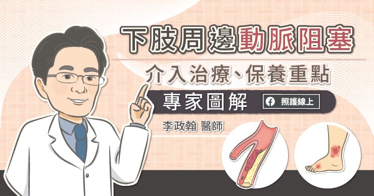 下肢周邊動脈阻塞,介入治療、保養重點,專家圖解