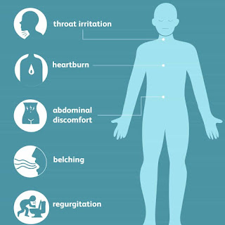 symptoms of hernia