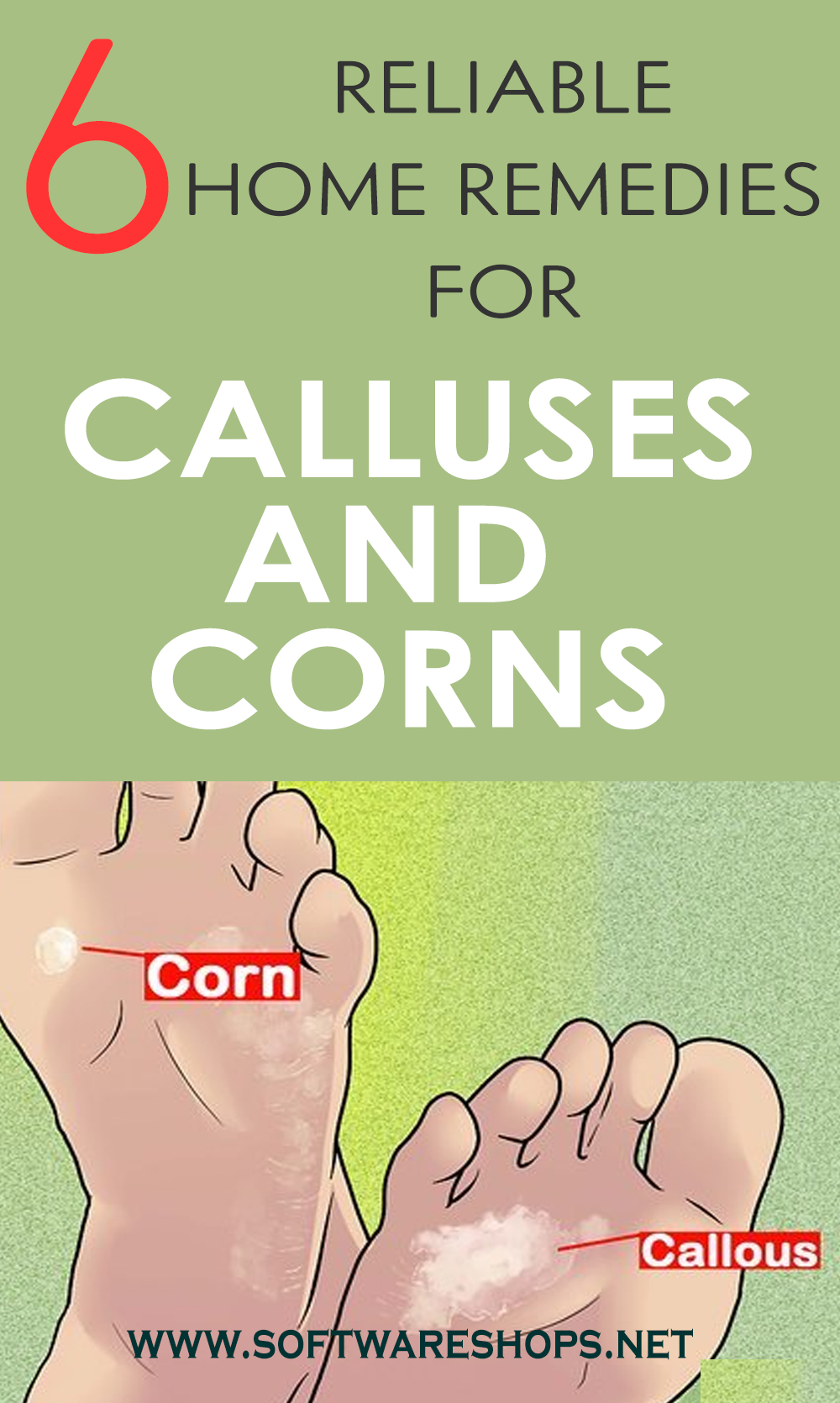 home remedies for calluses and corns