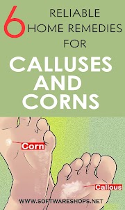 6 Reliable Home Remedies For Calluses And Corns