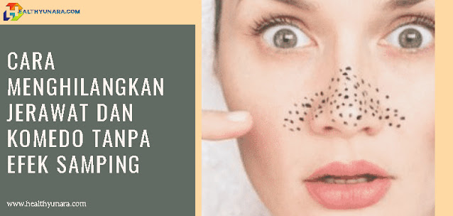 Cara Menghilangkan Jerawat Dan Komedo Tanpa Efek Samping Cara Menghilangkan Jerawat Dan Komedo Tanpa Efek Samping