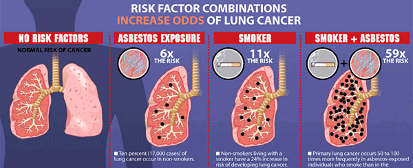 Lung Cancer: Lung Cancer Causes – Asbestos