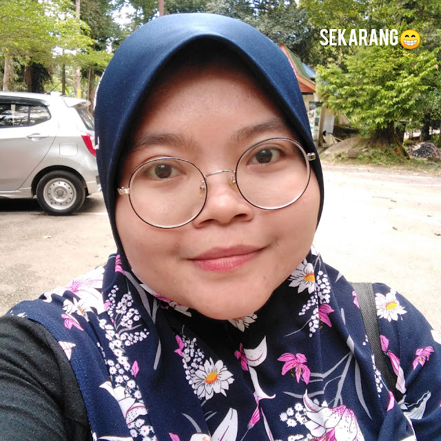 Ketuat Tanggal Selepas Guna Mole Cream + Serum Iriaz Ubat ketuat untuk muka, ubat ketuat, iriaz