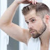Tips on Preventing Hair Loss