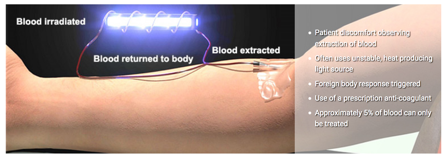 眼里的世界 Intravenous Light Therapy