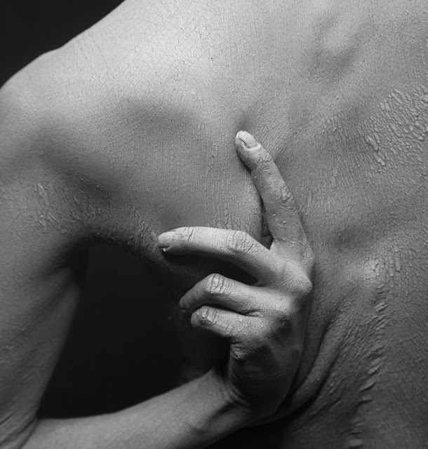 प्रेगनेंसी में खुजली के प्रकार -Types of itching in pregnancy